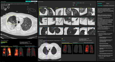 Radiologiebefund